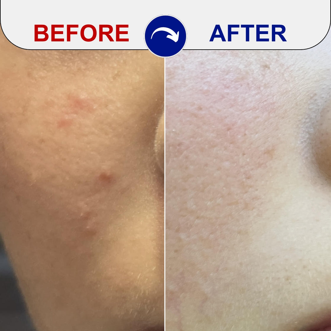 Before and After Image of user using the EMUAID® Clear + Repair